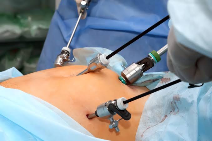 Best Laparoscopic Surgery Hospital in Rajkot - Advanced Surgical Care
